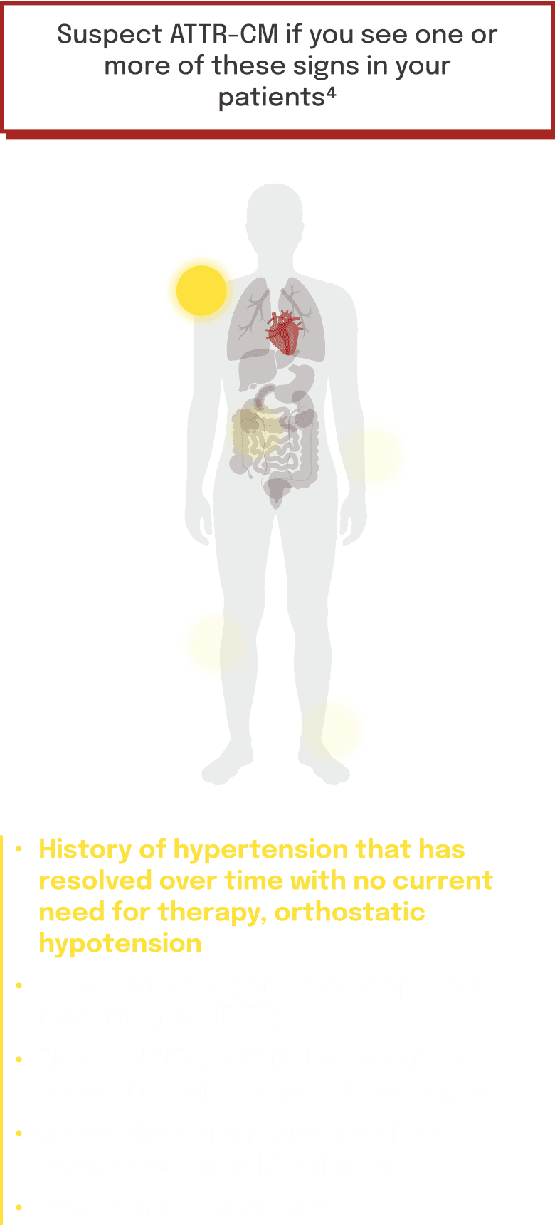 symptom locations and clinical signs associated with ATTR-CM on a human body