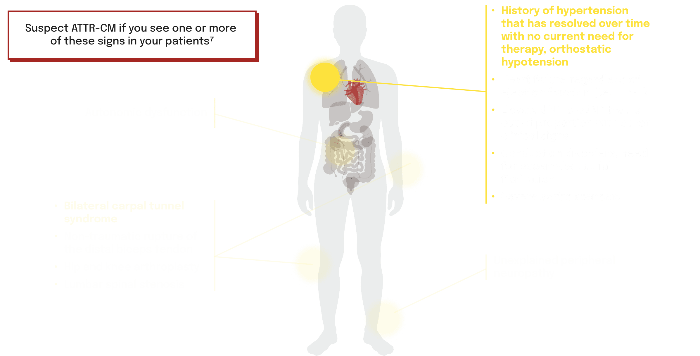 symptom locations and clinical signs associated with ATTR-CM on a human body