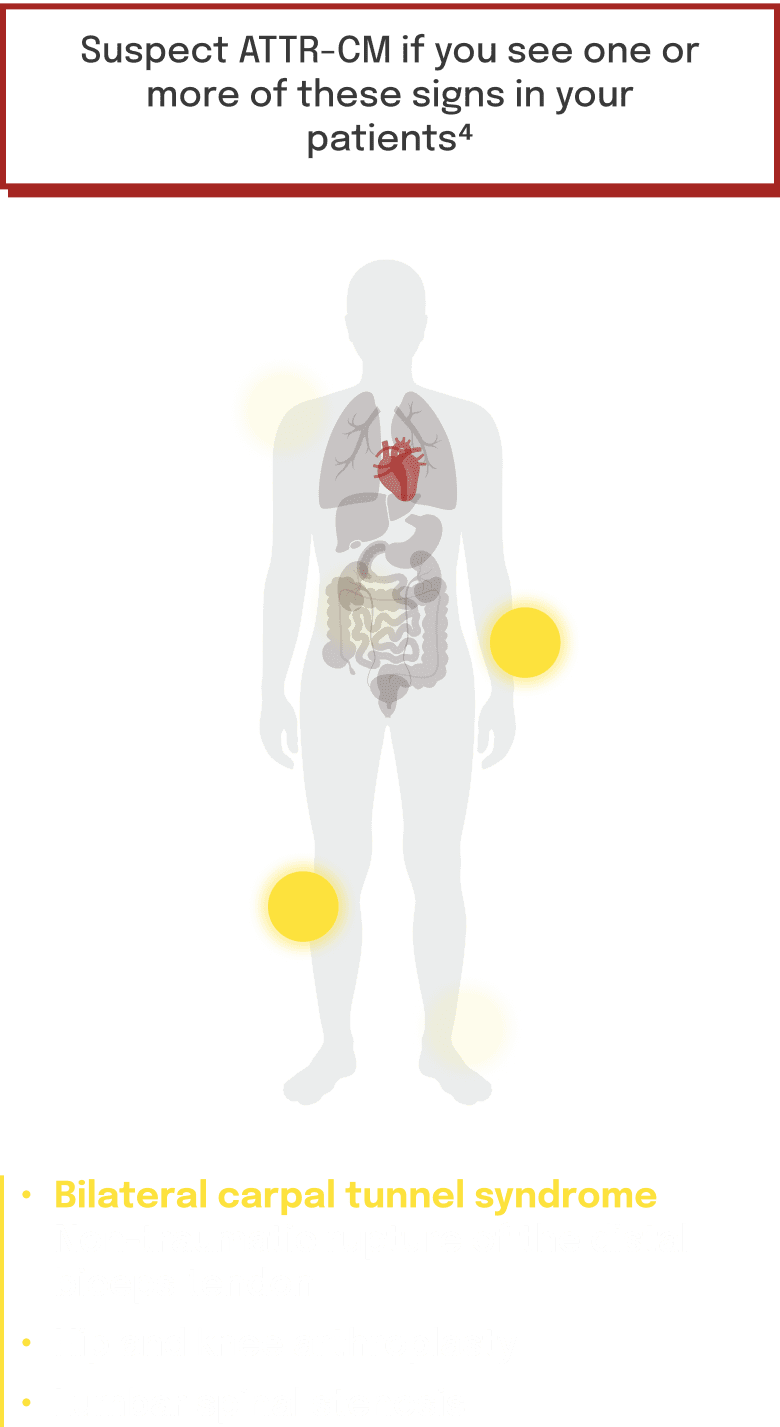 Early symptom indicators commonly associated
with ATTR-CM