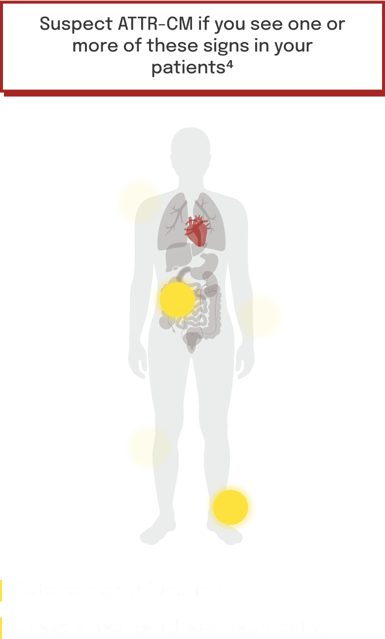 Body graphic highlighting symptom areas
commonly associated with ATTR-CM