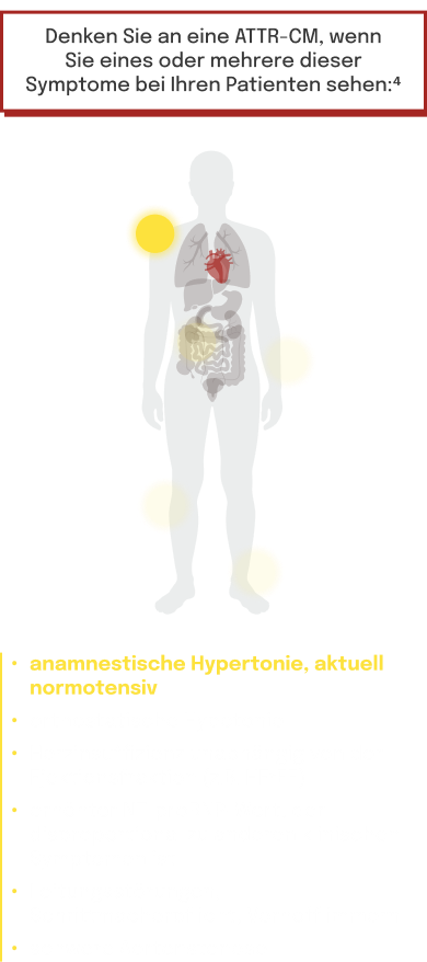 Symptomlokalisationen und klinische Zeichen im Zusammenhang mit ATTR-CM im menschlichen Körper
