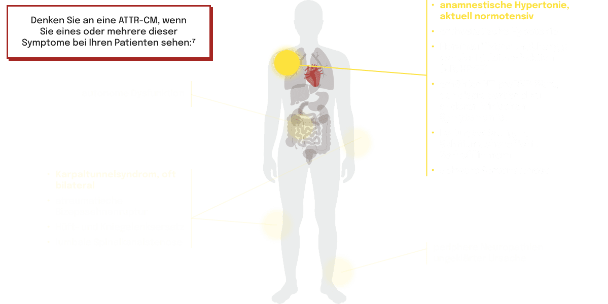 Symptomlokalisationen und klinische Zeichen im Zusammenhang mit ATTR-CM im menschlichen Körper