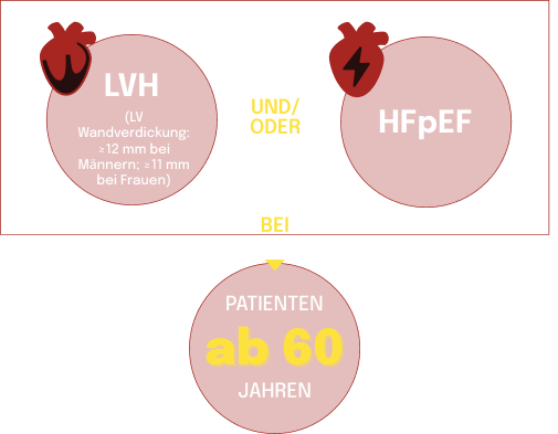 Infografik mit LVH- und HFpEF-Indikatoren bei Patienten über 60 Jahren